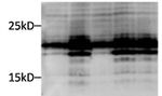 CRYAB Antibody in Western Blot (WB)