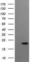 CRYGC Antibody in Western Blot (WB)
