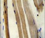 Citrate Synthase Antibody in Immunohistochemistry (IHC)