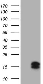 CSAG2 Antibody in Western Blot (WB)