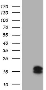 CSAG2 Antibody in Western Blot (WB)