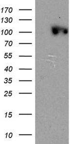 CSE1L Antibody in Western Blot (WB)