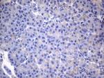CSF2 Antibody in Immunohistochemistry (Paraffin) (IHC (P))