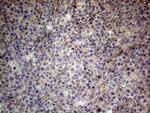 CSF2 Antibody in Immunohistochemistry (Paraffin) (IHC (P))