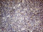 CSF2 Antibody in Immunohistochemistry (Paraffin) (IHC (P))
