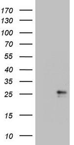 CSF2 Antibody in Western Blot (WB)