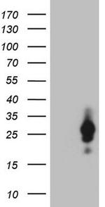 CSF2 Antibody in Western Blot (WB)