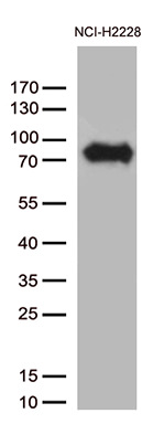 CSF2RA Antibody in Western Blot (WB)