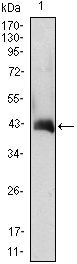 GM-CSF Monoclonal Antibody (3D3)