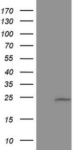 CSF3 Antibody in Western Blot (WB)