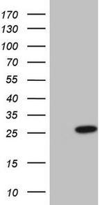 CSF3 Antibody in Western Blot (WB)