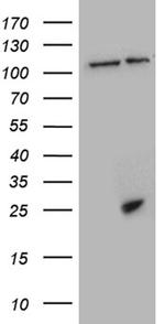CSF3 Antibody in Western Blot (WB)