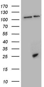 CSF3 Antibody in Western Blot (WB)