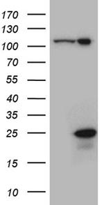CSF3 Antibody in Western Blot (WB)