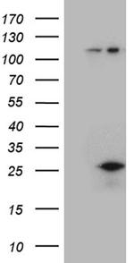 CSF3 Antibody in Western Blot (WB)