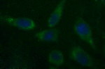 CSH1 Antibody in Immunocytochemistry (ICC/IF)