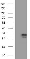 CSH1 Antibody in Western Blot (WB)