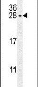 CSH1 Antibody in Western Blot (WB)