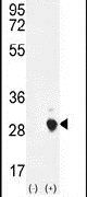 CSH1 Antibody in Western Blot (WB)