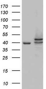 CSNK1E Antibody in Western Blot (WB)