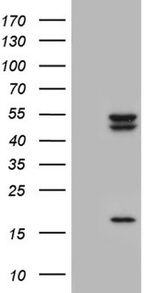 CSNK1E Antibody in Western Blot (WB)