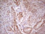 CSNK1G1 Antibody in Immunohistochemistry (Paraffin) (IHC (P))