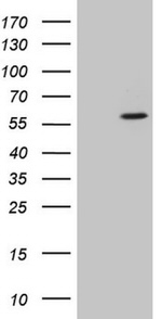 CSNK1G1 Antibody in Western Blot (WB)