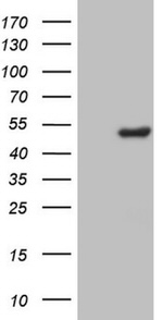 CSNK1G1 Antibody in Western Blot (WB)