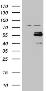 CSNK1G1 Antibody in Western Blot (WB)