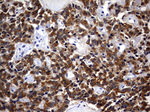 CSNK1G2 Antibody in Immunohistochemistry (Paraffin) (IHC (P))
