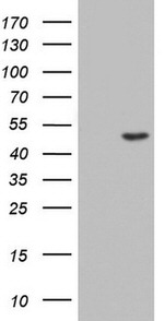 CSNK1G2 Antibody in Western Blot (WB)