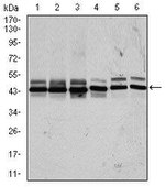 CK2 alpha-2 Monoclonal Antibody (1E1)