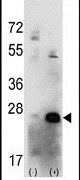 CK2 beta Antibody in Western Blot (WB)