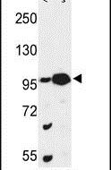 CSPP1 Antibody in Western Blot (WB)