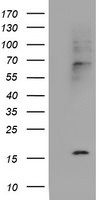 CST2 Antibody in Western Blot (WB)