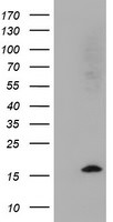 CST2 Antibody in Western Blot (WB)