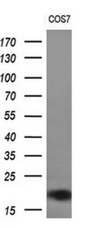 CST2 Antibody in Western Blot (WB)