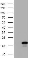 CST2 Antibody in Western Blot (WB)