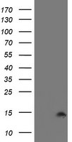 CST2 Antibody in Western Blot (WB)