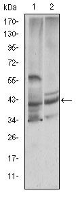 Cystatin C Monoclonal Antibody (5H2)