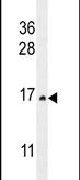Cystatin 9 Antibody in Western Blot (WB)