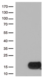 CSTB Antibody in Western Blot (WB)