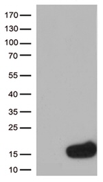 CSTB Antibody in Western Blot (WB)