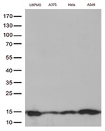 CSTB Antibody in Western Blot (WB)