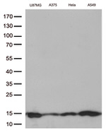 CSTB Antibody in Western Blot (WB)