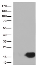 CSTB Antibody in Western Blot (WB)