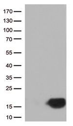 CSTB Antibody in Western Blot (WB)