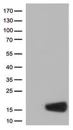 CSTB Antibody in Western Blot (WB)