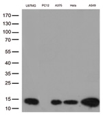 CSTB Antibody in Western Blot (WB)