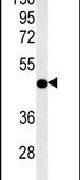 Citrate Synthase Antibody in Western Blot (WB)